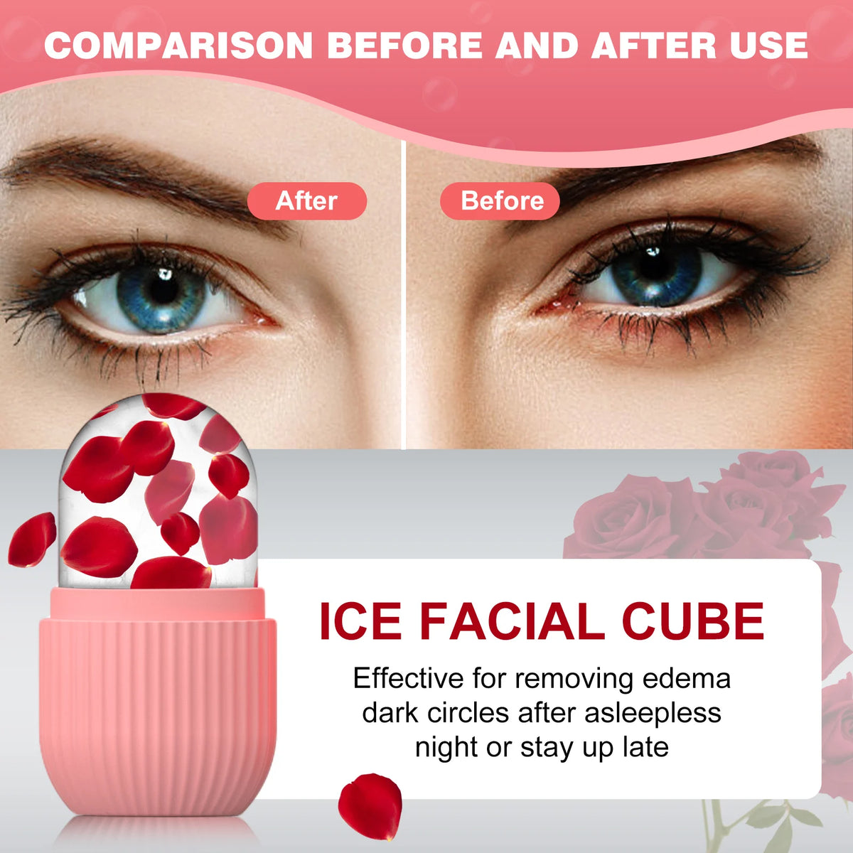 Silicone Face Ice Cube Mold & Roller below before-and-after under-eye comparisons